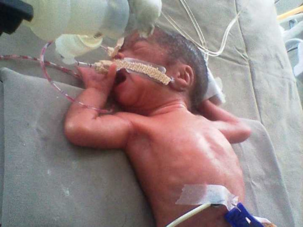 Help Baby Of Poonam To Survive
