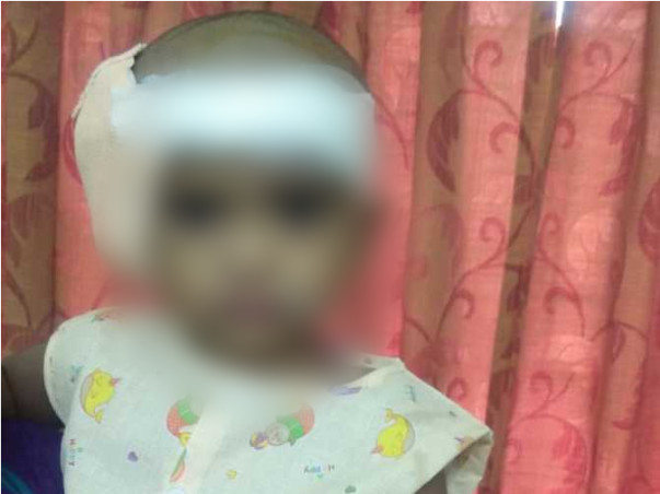 Help Mushahida Undergo A Cochlear Implant Surgery