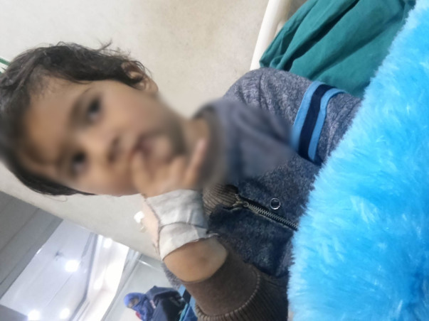 Help cute baby Recover From Idiopathic Thrombocytopenic Purpura