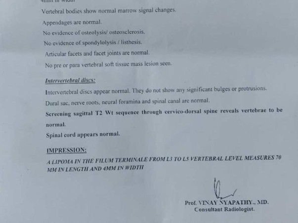 Detethering and dorsal scoliotic deformity correction