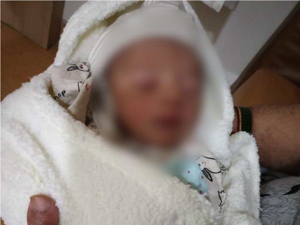Help 18 Days Old Arjun Fight Nonketotic Hyperglycinemia