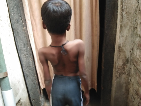 9 years old Sangam needs your help fight DUCHENE MUSCULAR DYSTROPHY