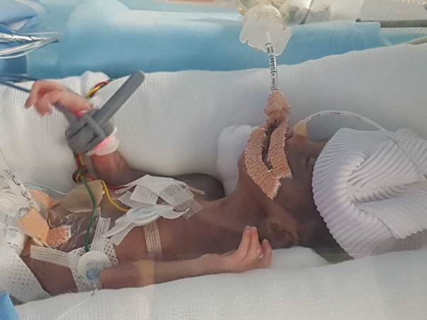 Help Baby Of Sowjanya To Survive