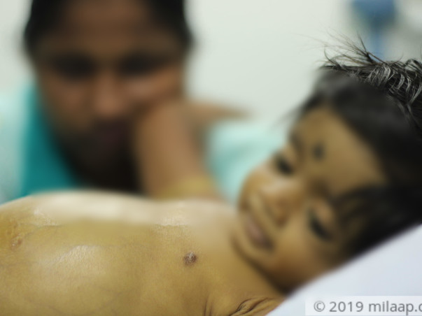 Help Magizhini Fight Biliary Atresia And Undergo A Liver Transplant