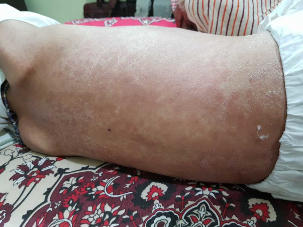 Help Hamza Fight Blood Cancer