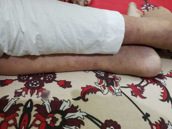 Help Hamza Fight Blood Cancer