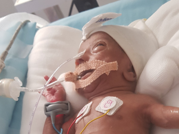 Help Baby Of Shalini: Premature Birth