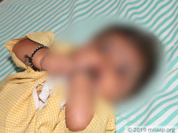 A 6 Month Old Is Struggling With Bone Marrow Transplantation, Help Her