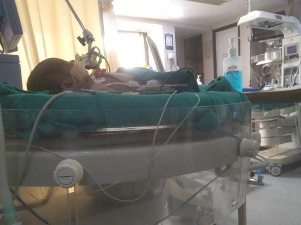 Support Rudra Recover From Ventricular Septal Defect