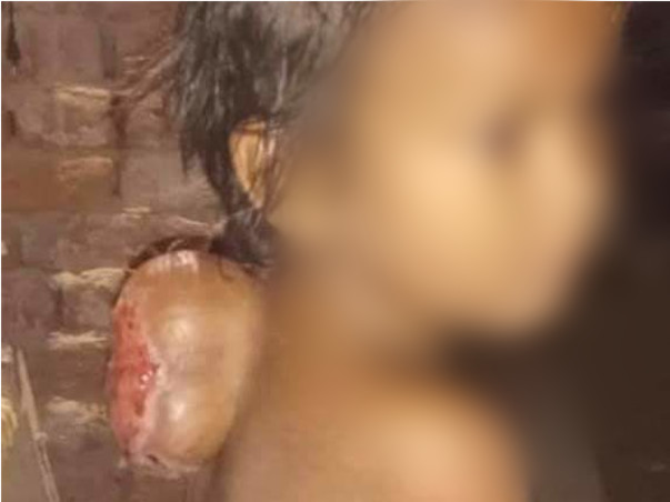 5 Years Old Rajbeer Needs Your Help Congenital Diseases