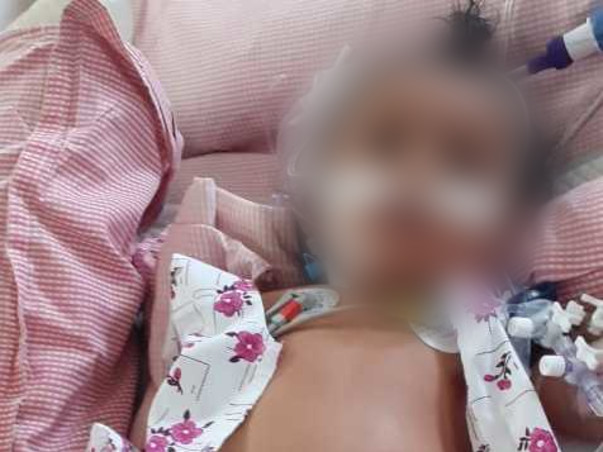 8 Months Old Mintu Needs Your Help Fight HLM secondary