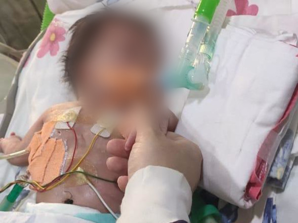 26 Days Old Baby Needs Your Help Fight Hydrops with chylothorax