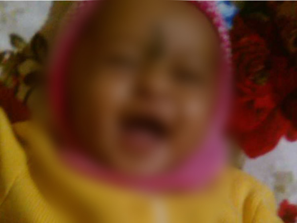 Without Your Help, This Baby Could Lose His Sight Just Like His Father