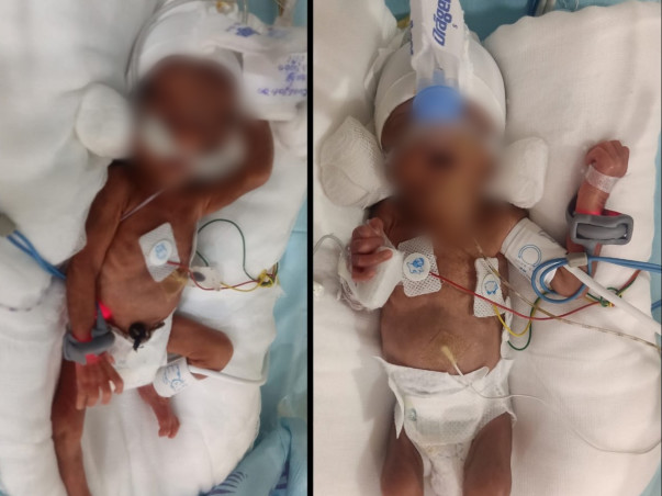 Help Premature twins