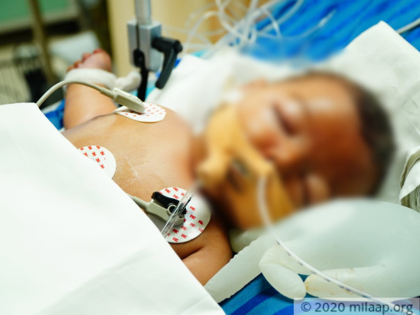 Help Vishvas Fight Life Threatening Infection