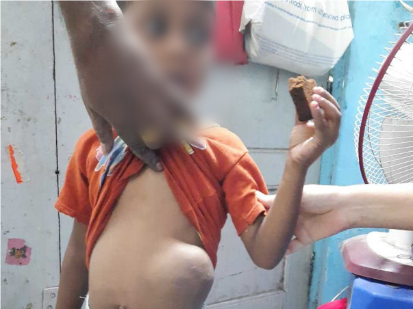 Support Kartik Halgi Recover From Stomach Cancer