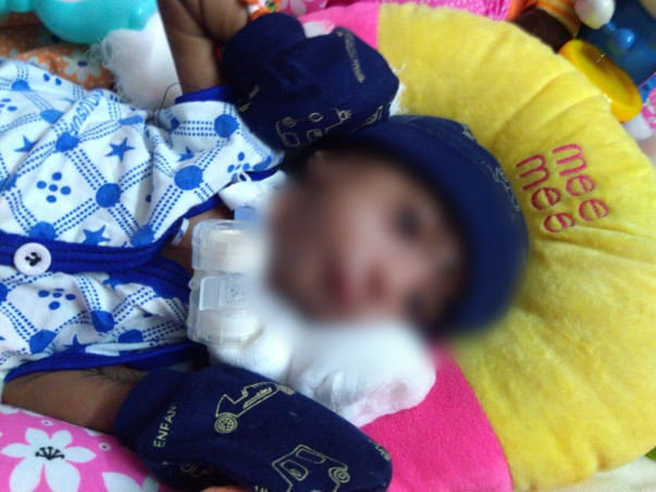 This 1 Month Old Needs Your Urgent Support In Fighting Atrial Septal Defect (Asd)