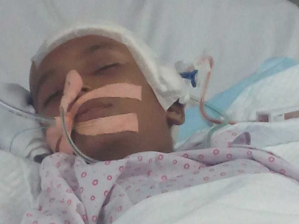 Help Madhumita Adhikari Recover From Brain Surgery