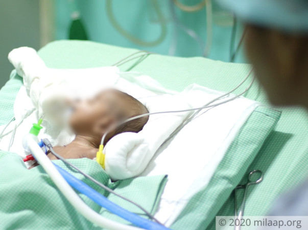 Before They Could Even Name Their Newborn, He Is Fighting For His Life