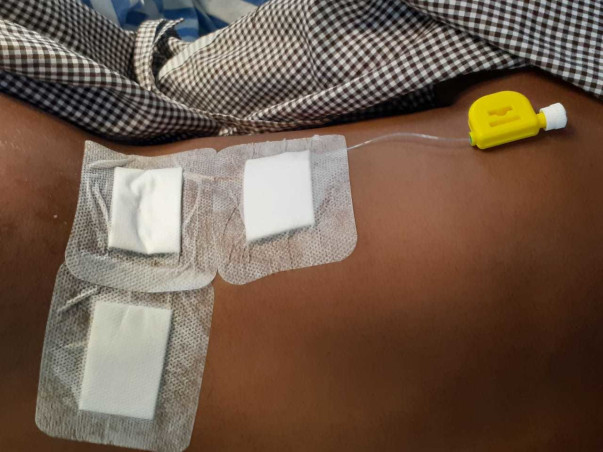 Help Indhumathi from the excruciating pain