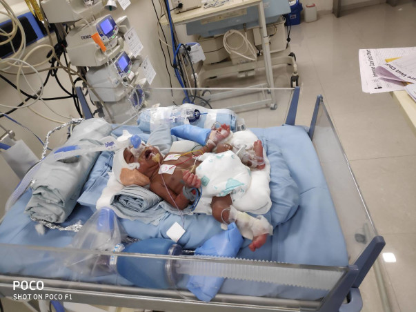 Help New Born Baby To Recover From Respiratory Distress Syndrome