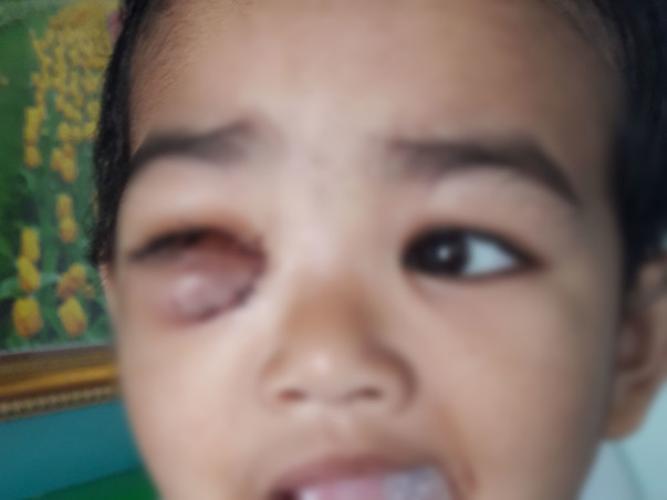 2 Years Old Ridip Karmakar Needs Your Help To Fight For Malignant Cancer