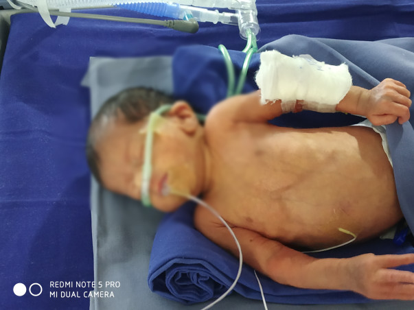 Please Help My New Born Baby to Recover!