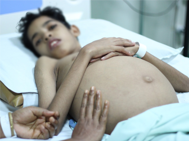 My brother needs a liver transplant and need your help