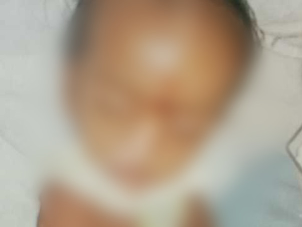 My Son Is Struggling With Brian Injury & Fits, Help Him