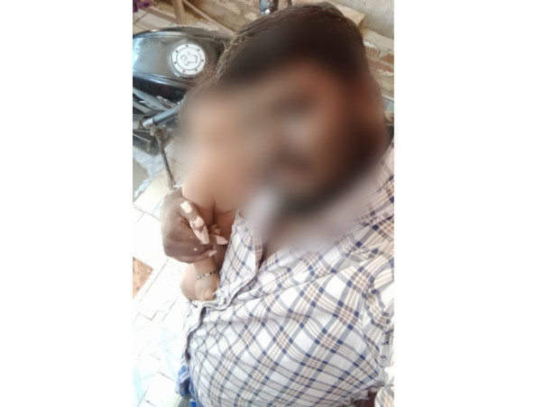 Driver Struggles To Save His 8-Month-Old From Aggressive Brain Tumour