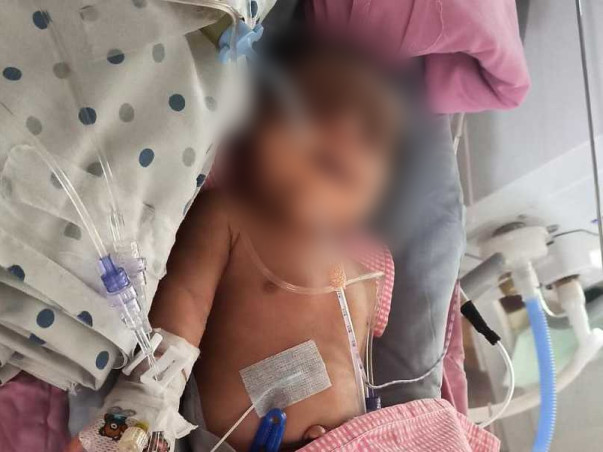 5 Days Old Baby Of Sai Krupa Needs Your Help Fight Polyhydramnios