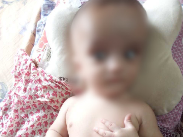 This 5-Month-Old Can Turn Completely Blind Without An Urgent Surgery