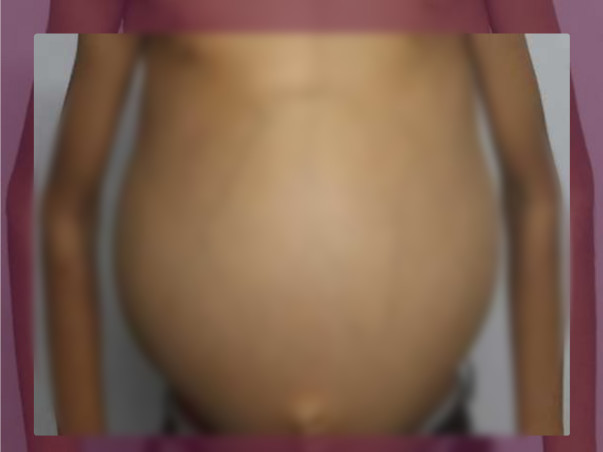 Help Dilliganesh for liver inflammation