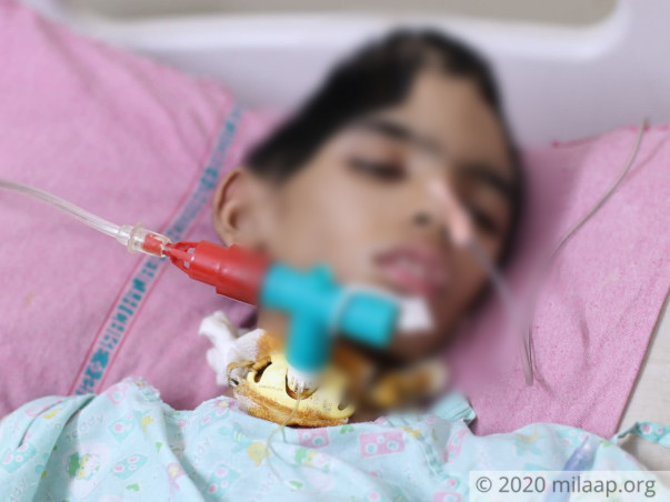 Half Of This 10-Year-Old's Skull Had To Be Removed Due To Rare Tumor