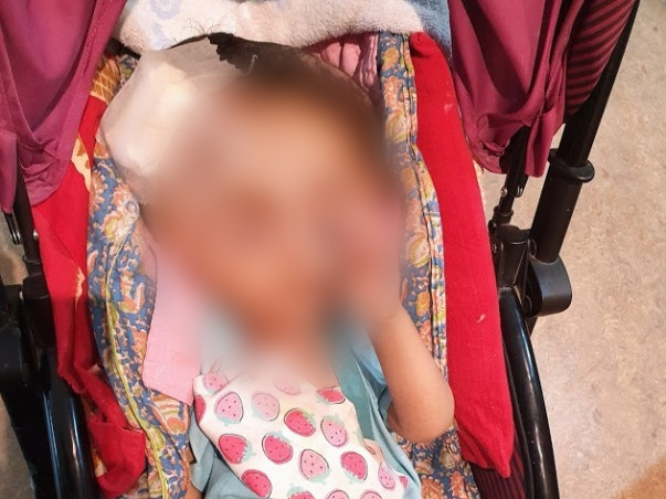 Without Immediate Surgery, This Baby May Never See, Walk, Sit Or Speak