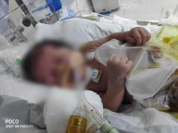 "Baby of Heena"has gone through multiple interstine surgeries,Help Her