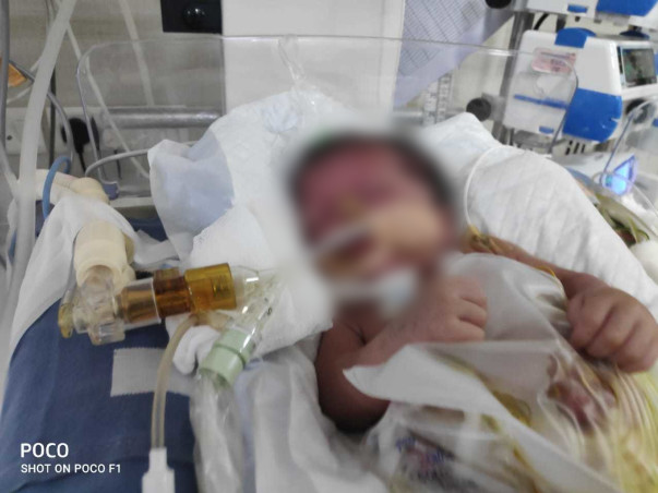 "Baby of Heena"has gone through multiple interstine surgeries,Help Her