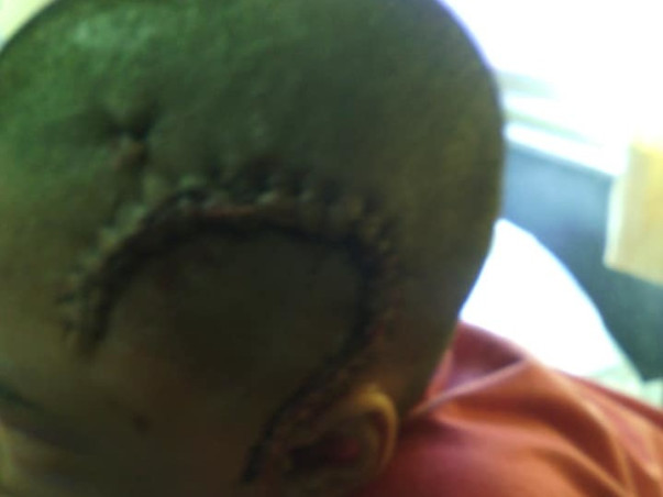 ASSIT A HELPLESS PRIVATE TEACHER SAVE HIS DAUGHTER FROM EPILEPSY