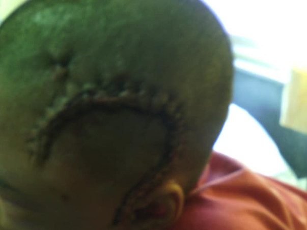 HELP PRASANNA FIGHT AGAINST EPILEPSY