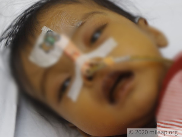 Support little Poorvi fight against metabolic liver failure