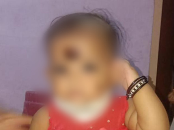 Support Deekshitha Recover From Dengue fever &  Pericardial effusion
