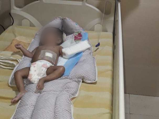 11 Months Old Myasarvin Needs Your Help Fight Hydrocephalus