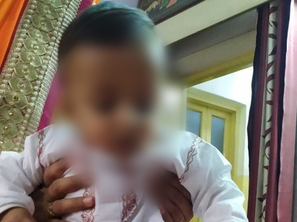 1 year old Nakshatra needs your help fight Acute lymphoblastic leukemia (all)