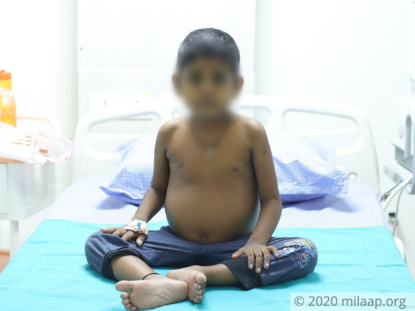 6-Year-Old Might Not Make It Without An Urgent Liver Transplant