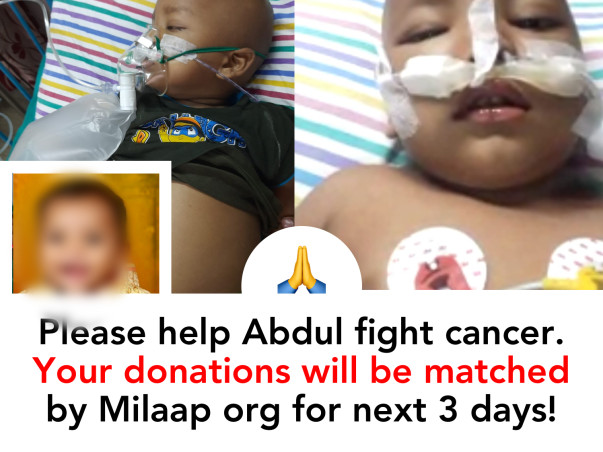 2 yr old kid Abdul needs your help fight cancer. Please save the child