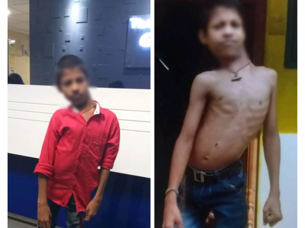 Support Yuvaraj - Spinal Disorder surgery