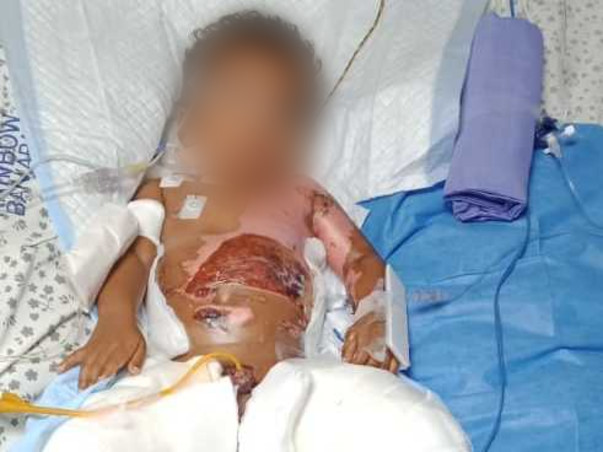 My son is in the ICU battling for his life and needs your help