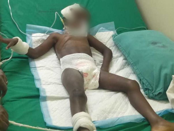 Help 4 Years Old Lakshan Undergo Brain Surgery