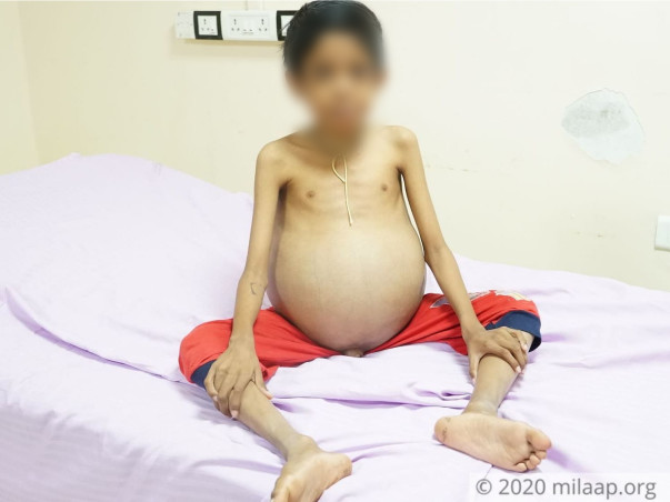 This 9-Year-Old's Stomach Could Burst Any Moment