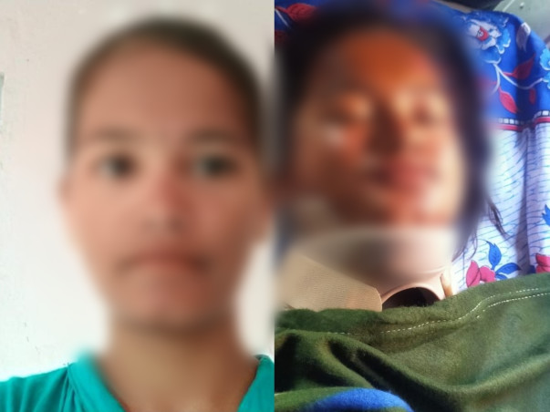 Support Shirisha Recover From Road Traffic Accident